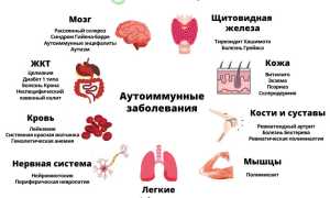 Аутоиммунные заболевания. Список болезней, симптомы и лечение
