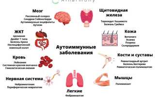 Аутоиммунные заболевания. Список болезней, симптомы и лечение