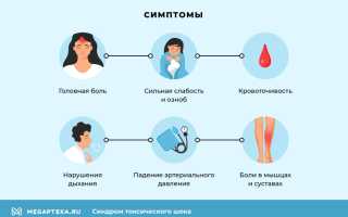 Синдром токсического шока (СТШ). Что это такое, симптомы, как избежать, лечить