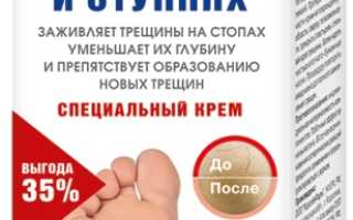 Мази и кремы от натоптышей на ногах: ступнях, пальцах, подошве