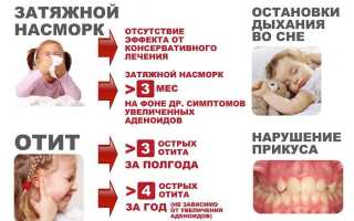 Хронический аденоидит у детей. Симптомы, лечение
