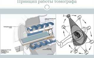 МРТ тазобедренного сустава. Цена, что показывает, как делают, подготовка у взрослых, детей