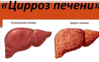 Боль в правом подреберье спереди. Причины, возможные заболевания. Лечение, диагностика