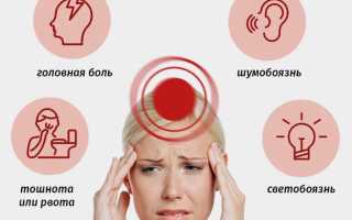 Головные боли при шейном остеохондрозе. Симптомы и лечение