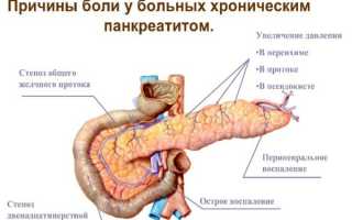 Диета при панкреатите поджелудочной железы. Меню на неделю, рецепты, продукты, что нельзя