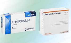 Амоксициллин или Азитромицин. Что лучше, разница, что эффективнее