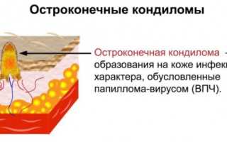 ФДТ в гинекологии. Отзывы, цена, что это такое