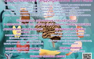 Заболевания эндокринной системы, нарушения. Симптомы, список болезней