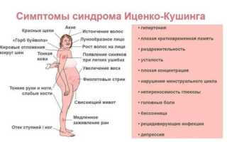 Аденома гипофиза. Симптомы, что это такое, прогноз