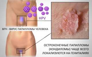Индинол Форто. Отзывы женщин, принимавших препарат, состав, аналоги