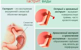 Кальция карбонат (Calcii carbonas). Что это такое, инструкция по применению, аналоги, цена, отзывы