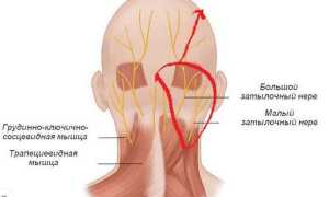 Боль в шее и затылке. Причины и лечение