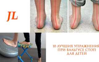 Упражнения для стоп при плоскостопии, вальгусной деформации