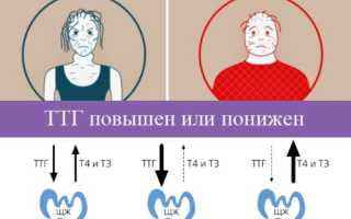 Анализ крови, слюны для похудения: на пищевую непереносимость, гормоны, нутригенетический