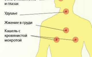 Отравление хлором. Симптомы и лечение, народные средства, первая помощь