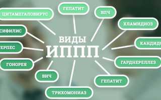 ЗППП (заболевания передающиеся половым путем) у женщин. Симптомы, таблица