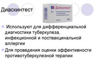 Диаскинтест. Противопоказания у детей, с какого возраста, норма, оценка