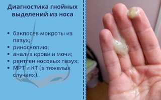 Гнойные выделения из носа, желтые густые сопли, запах гноя. Чем лечить