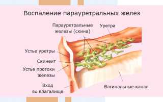 Парауретральные железы у женщин, мужчин. Что это такое, где находятся, функции