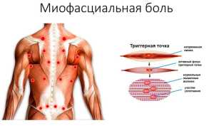 Миофасциальный массаж. Что это такое, для чего нужен