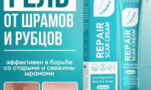 Мазь от шрамов и рубцов. Список самых эффективных средств заживления кожи