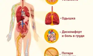 Признаки сердечной недостаточности. Симптомы у женщин, мужчин