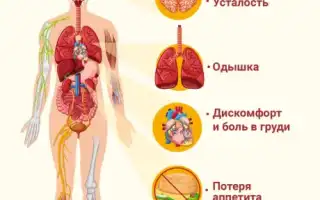 Признаки сердечной недостаточности. Симптомы у женщин, мужчин