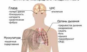 Гипоксия. Что это такое у взрослых, симптомы и лечение