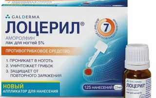 Противогрибковые средства для ногтей на ногах, руках, эффективные и недорогие