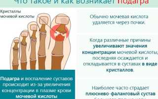 Лечение подагры при обострении: медикаменты, уколы