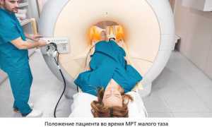 МРТ малого таза. Подготовка у женщин к исследованию, что показывает с контрастированием