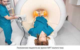 МРТ малого таза. Подготовка у женщин к исследованию, что показывает с контрастированием