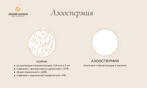 Азооспермия. Что это такое, лечится или нет