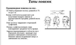 Передняя тампонада носа. Алгоритм действий, показания, как выполняется