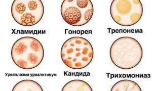 Урологические заболевания у мужчин. Симптомы и лечение болезней