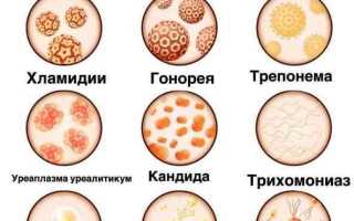 Урологические заболевания у мужчин. Симптомы и лечение болезней