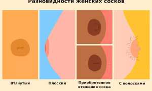 Большие соски и крупные ареолы груди у девушек. Причины