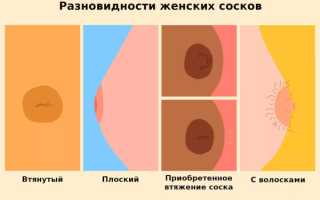 Большие соски и крупные ареолы груди у девушек. Причины