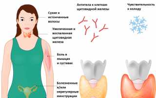 Антитела к тиреоглобулину повышены у женщин. Причины, симптомы, лечение