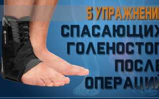 Упражнения после перелома лодыжки после снятия гипса