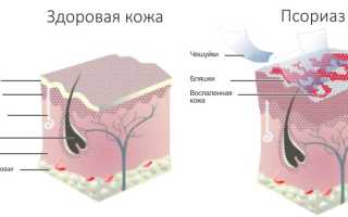 Мази от раздражения на коже у взрослых на лице, руках, теле, в интимных местах. Цены и отзывы