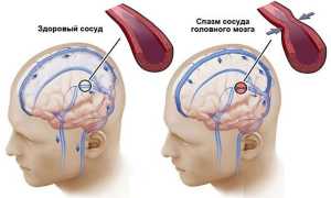 Болит шея, закладывает уши, кружится голова. Что это значит