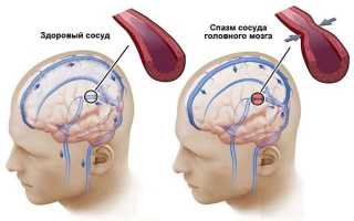 Болит шея, закладывает уши, кружится голова. Что это значит