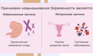 Замершая беременность. Признаки в первом триместре, симптомы, причины