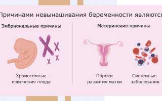 Замершая беременность. Признаки в первом триместре, симптомы, причины