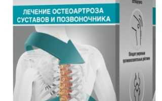 Артра (Artra). Отзывы больных применяющих этот препарат, инструкция, аналоги, цена