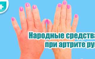 Ревматоидный артрит. Симптомы и лечение, препараты, народные средства
