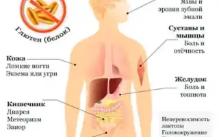 Анализ на глютеновую непереносимость. Как сдавать, как проводят, расшифровка