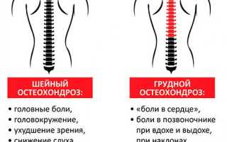 Обострение остеохондроза шейного отдела позвоночника. Симптомы, лечение