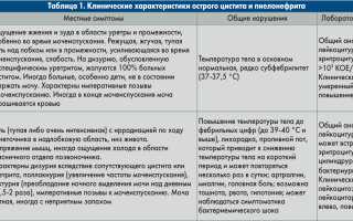 Анализы при цистите у женщин, мужчин, ребенка